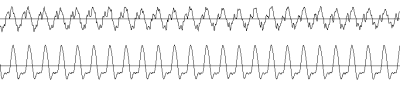 Una décima de segundo de un Re con piano (arriba) y con flauta (abajo).